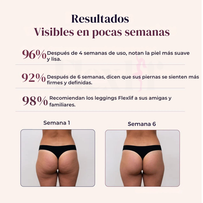 ©Flexlif 4 en 1 Efecto Tights - Celulitis, Varices, Lipedema, Adelgazamiento