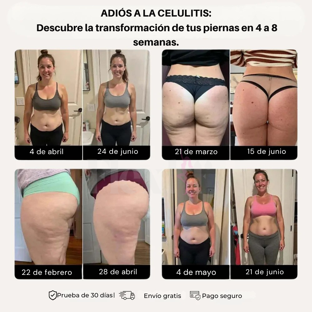 ©Flexlif 4 en 1 Efecto Tights - Celulitis, Varices, Lipedema, Adelgazamiento