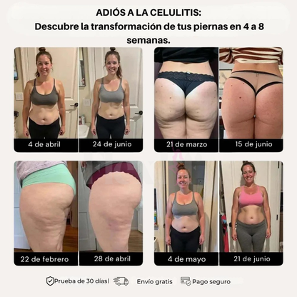 ©Flexlif 4 en 1 Efecto Tights - Celulitis, Varices, Lipedema, Adelgazamiento